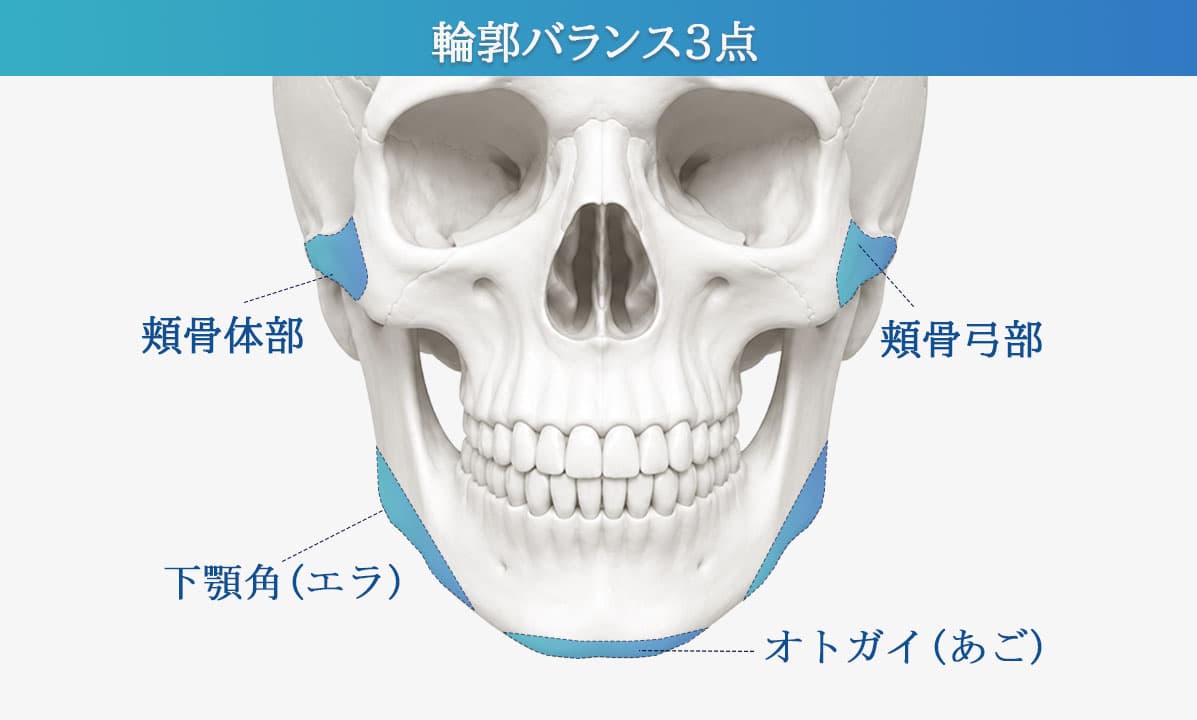輪郭3点手術の比較イメージ